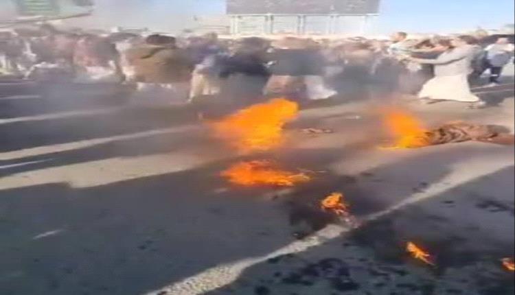 شاب يضرم النار بجسده في صنعاء بعد تعرضه لاعتداء عنيف على يد مسلحين