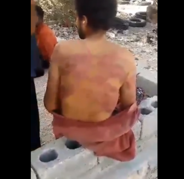 شاهد فيديو صادم يهز مواقع التواصل يوثق تعرض شاب يمني للتعذيب الوحشي في سلطنة عمان