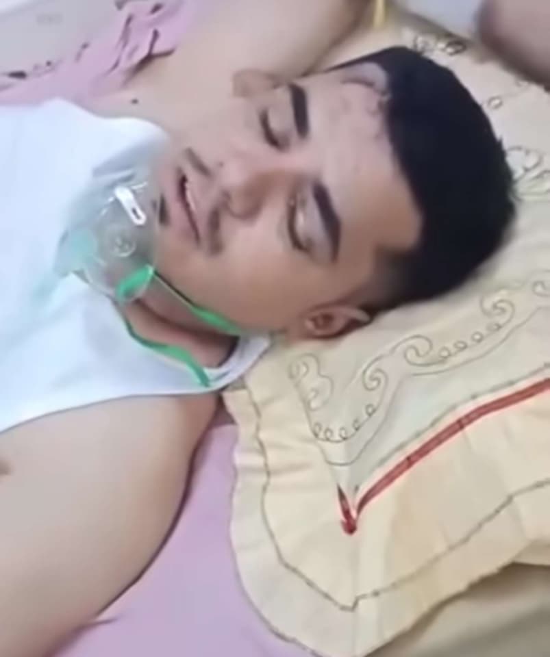 تفاصيل مرعبة من داخل الباص المحترق في أبين.. ناجٍ يروي اللحظات الأخيرة