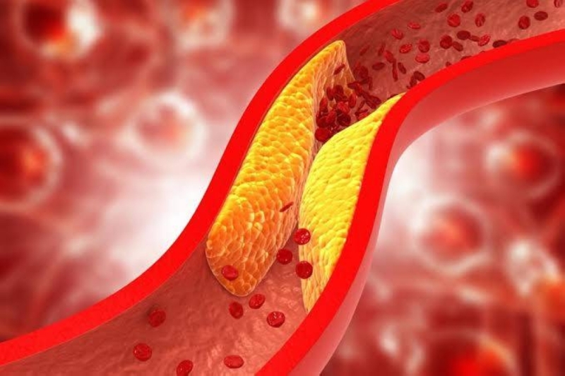 الكشف عن نوع من الخضار يخفض ضغط الدم والكوليسترول